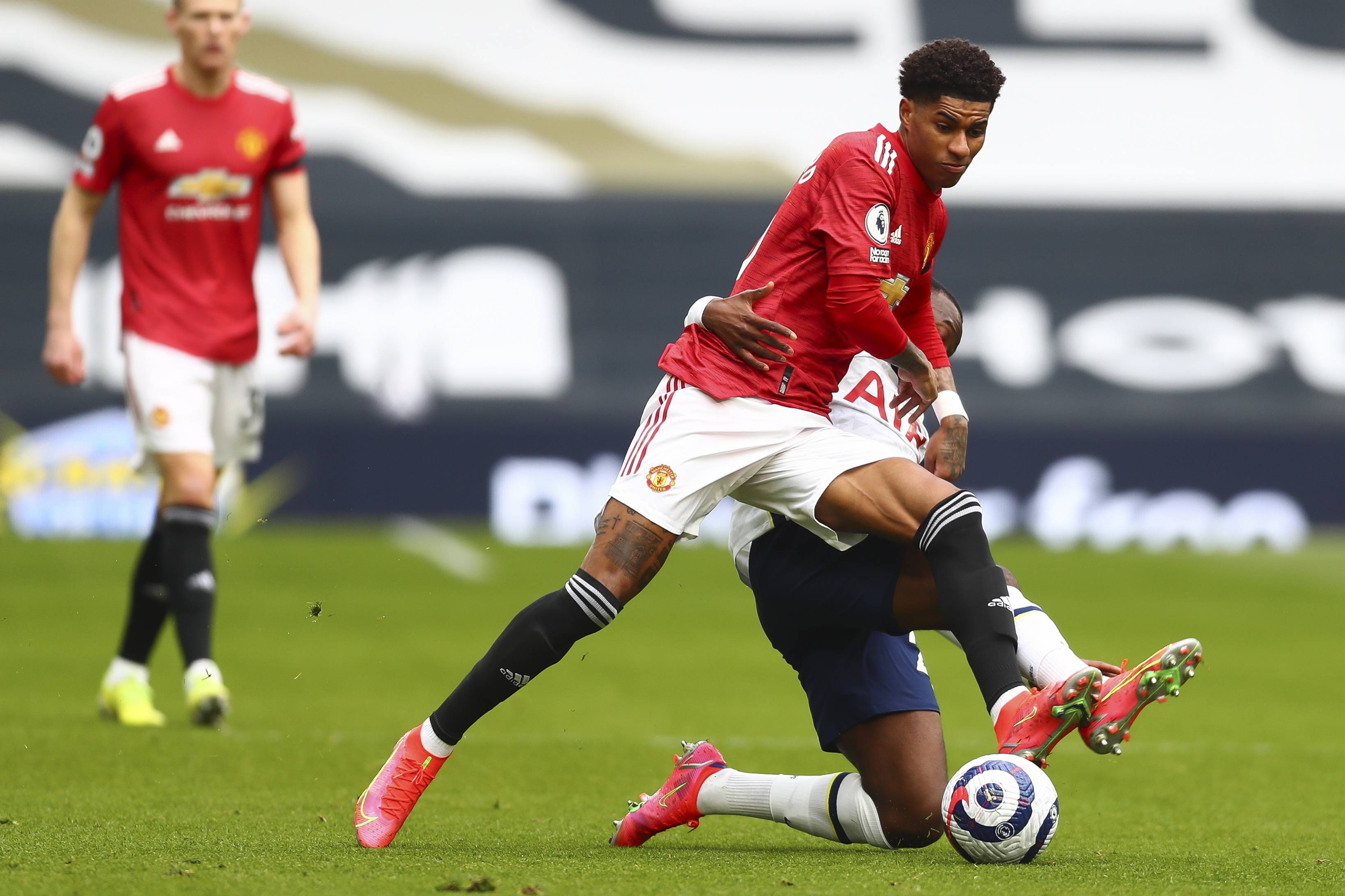 小腿骨折 小腿骨折